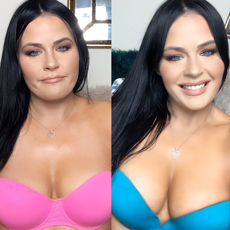 Upbra before and after