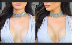 Upbra before and after