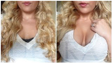 Upbra before and after